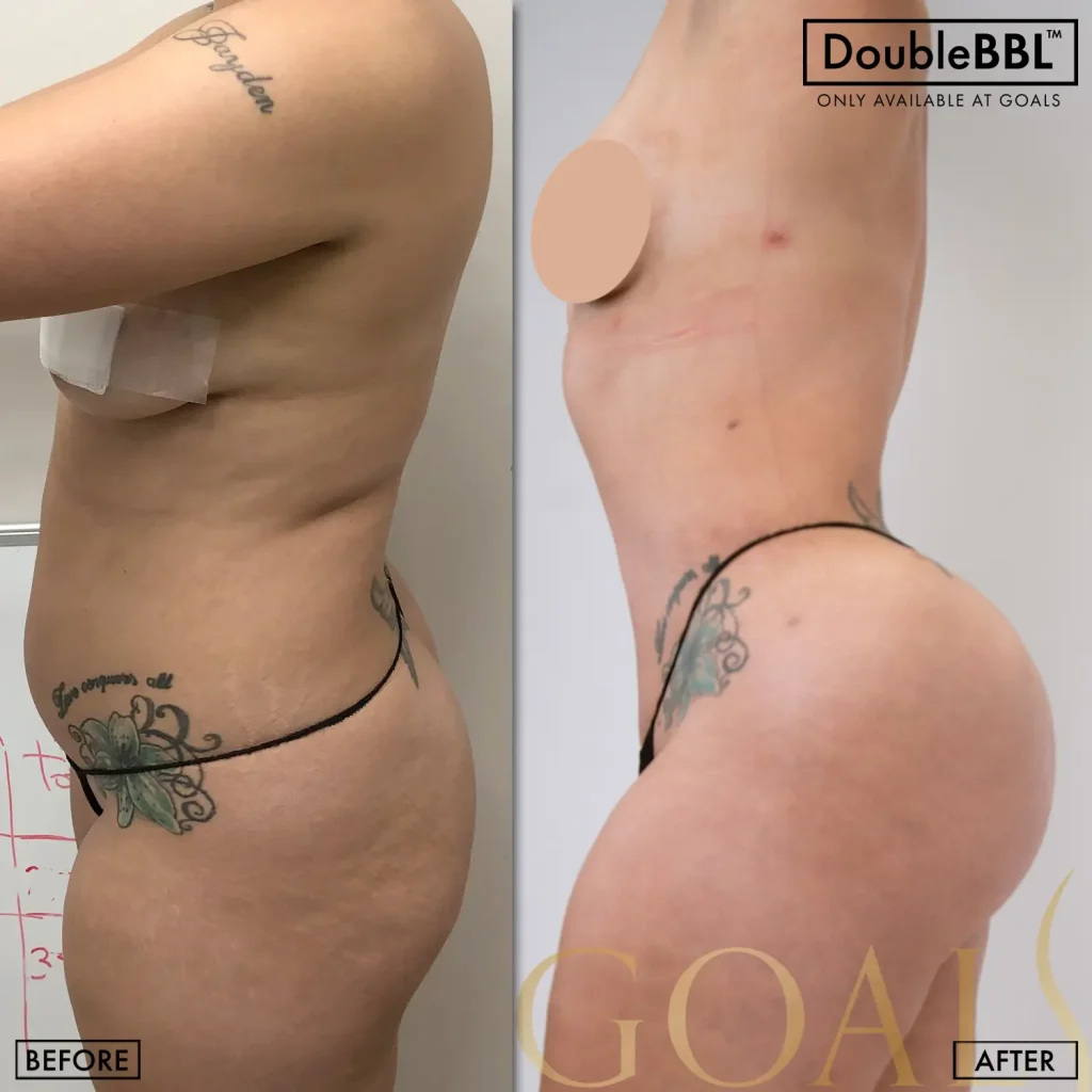 Before and after, patient 6