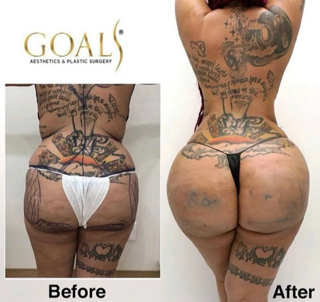 Before and after — Harlem, patient 2