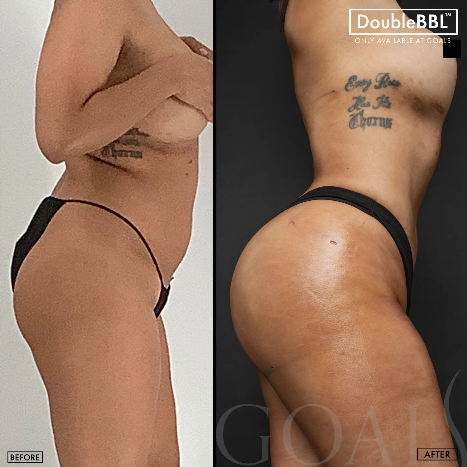 Before and after, patient 1