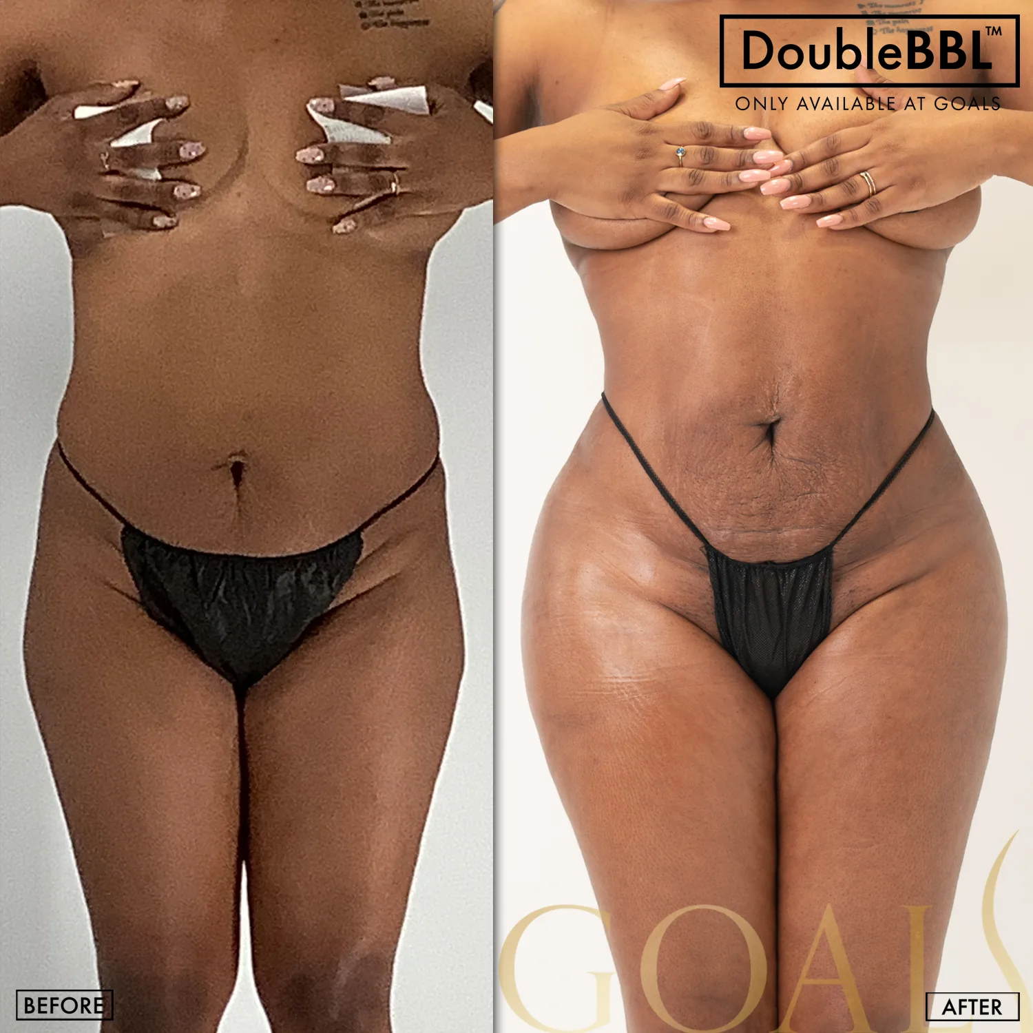 Before and after, patient 6