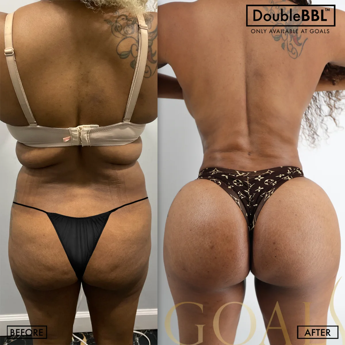 Before and after — Ridgefield, patient 3