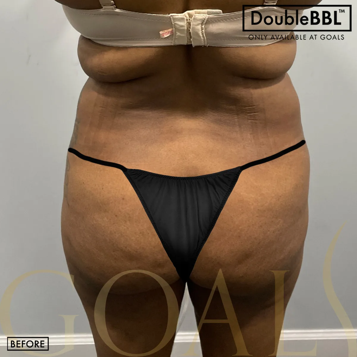 Before and after — Ridgefield, patient 5