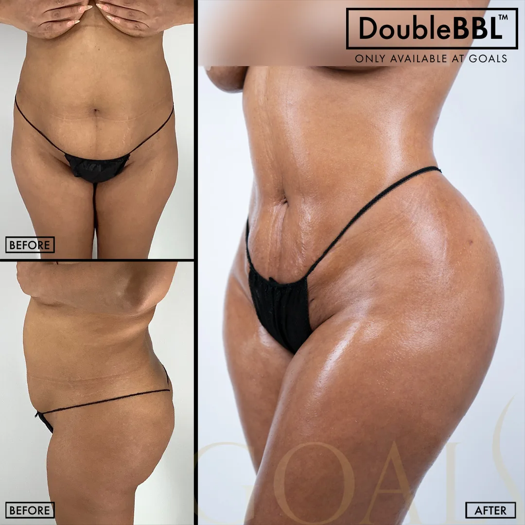 Before and after, patient 2