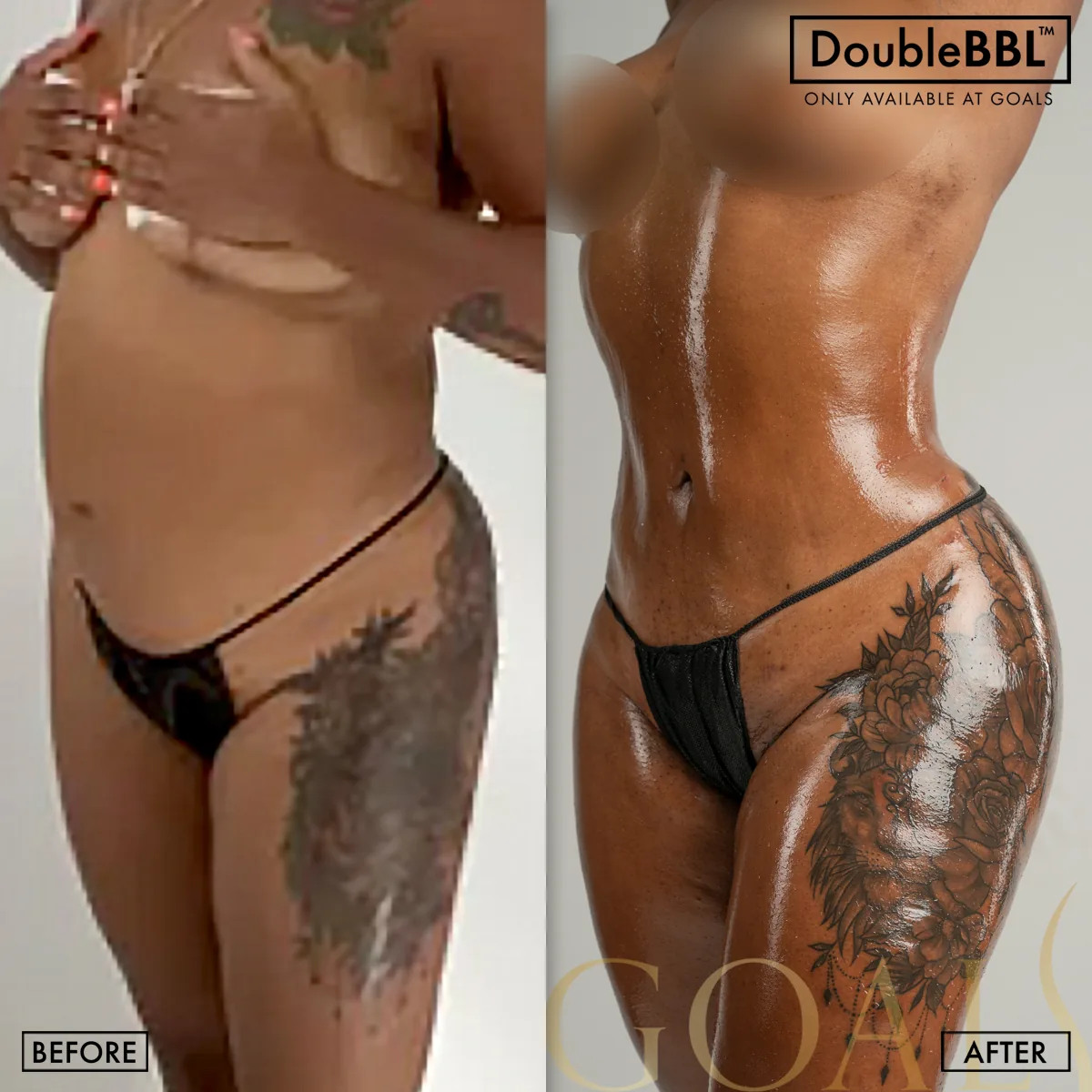 Before and after, patient 4
