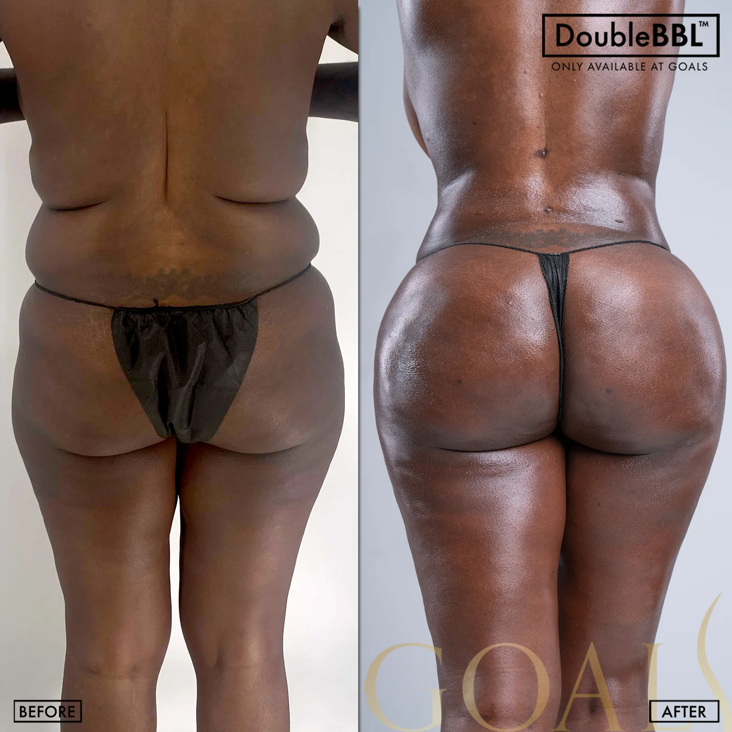 Before and after, patient 1