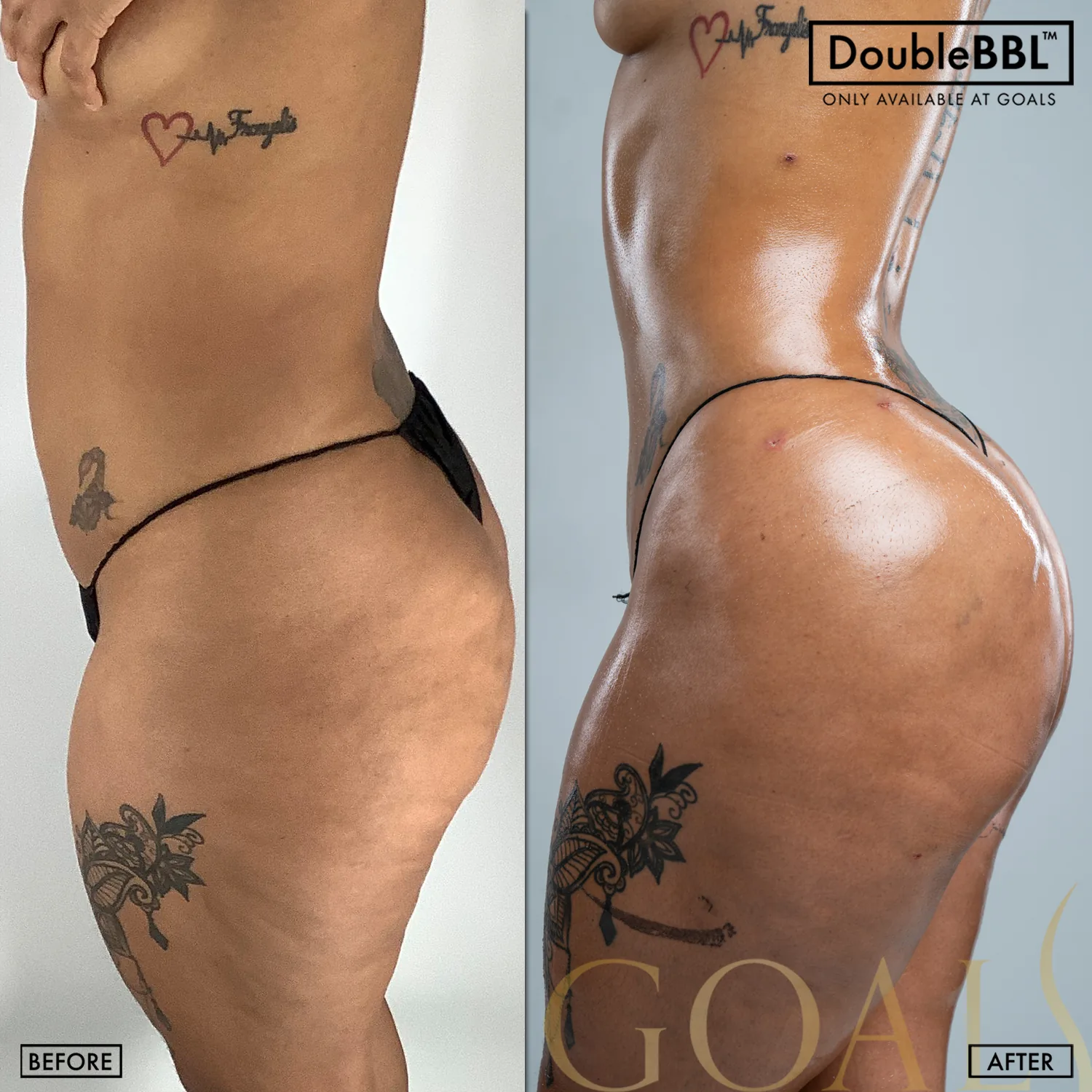 Before and after, patient 2