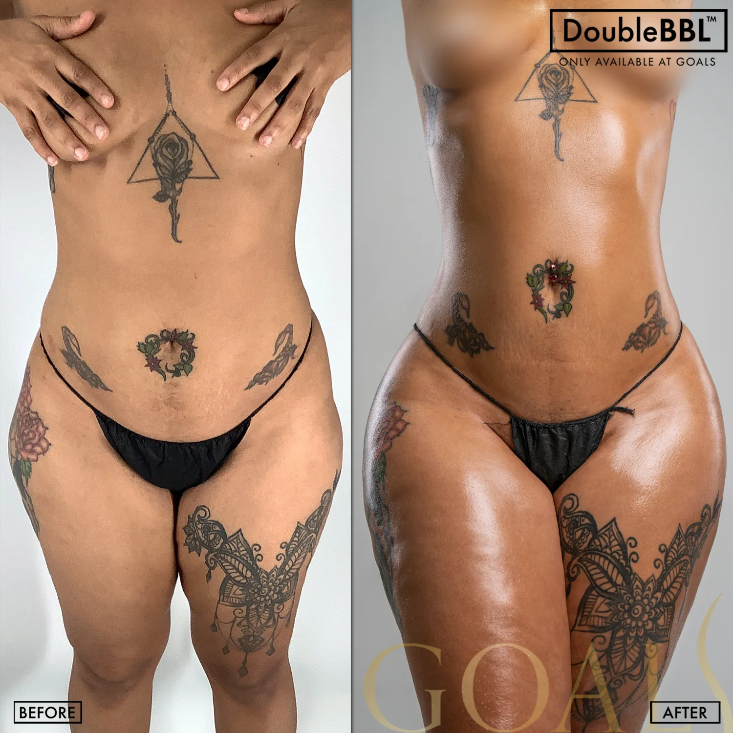 Before and after, patient 5