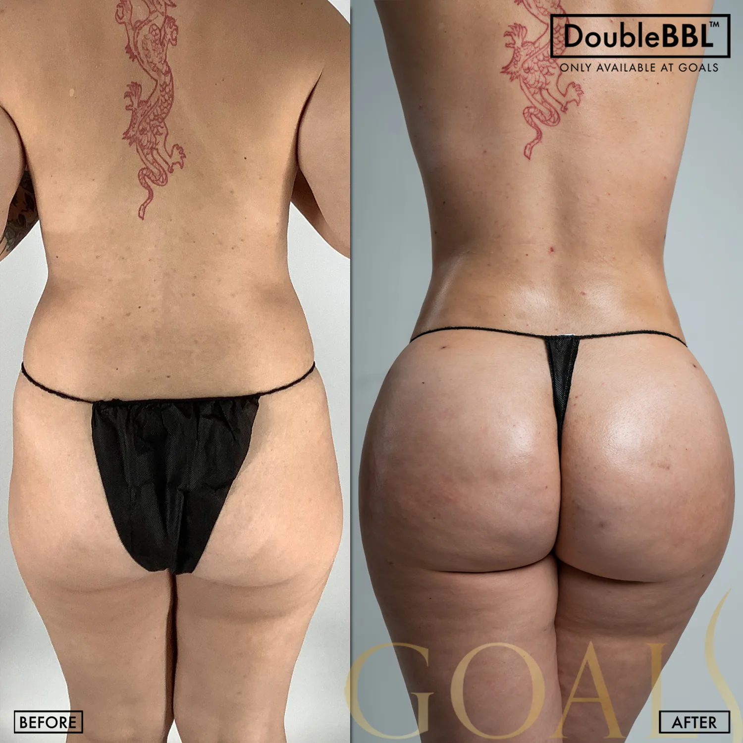 Before and after, patient 1