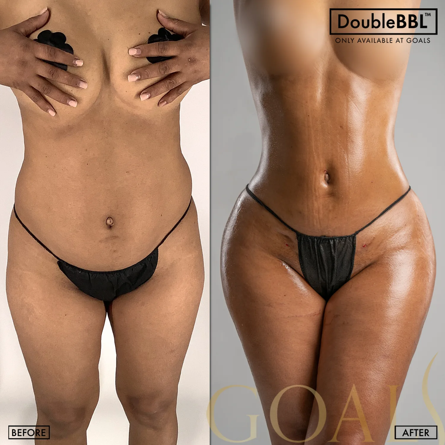 Before and after, patient 2