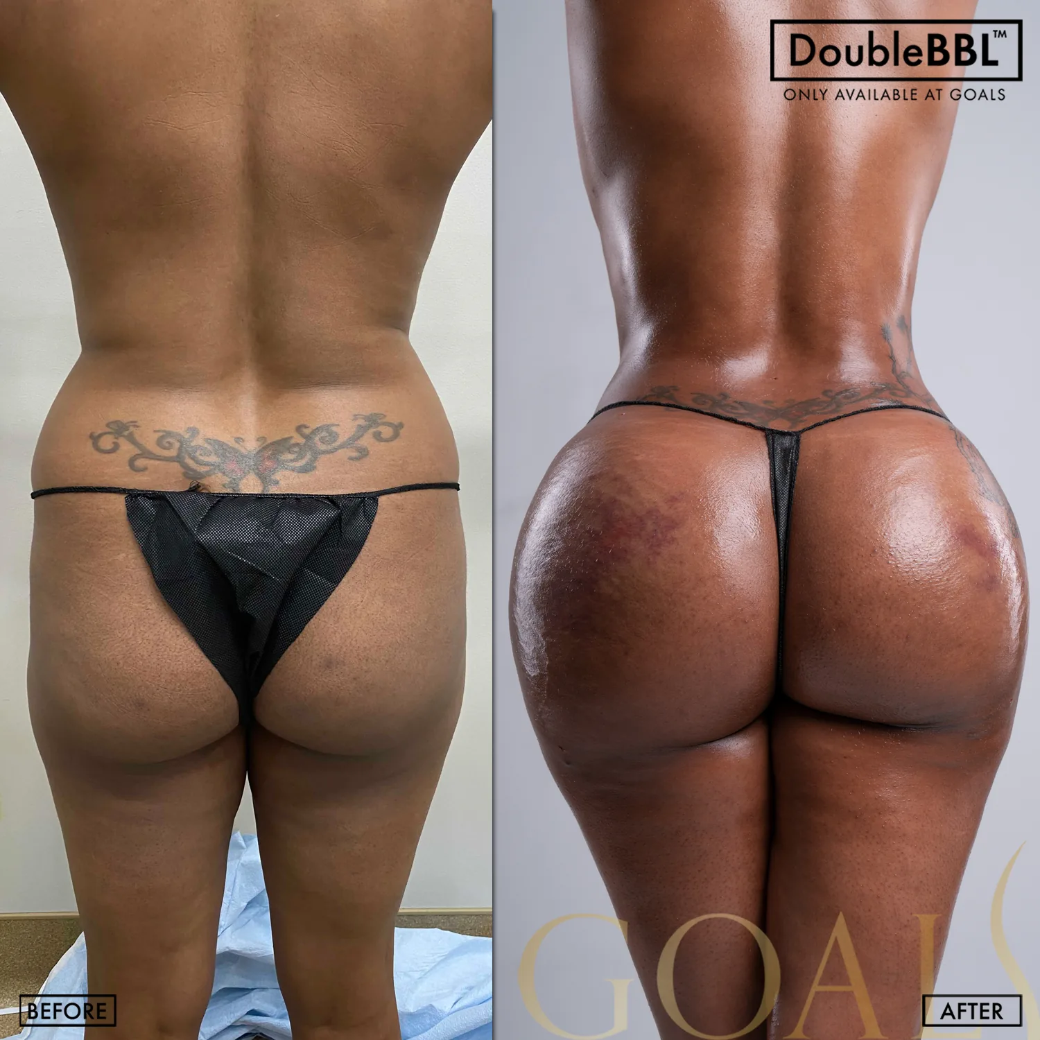 Before and after, patient 3