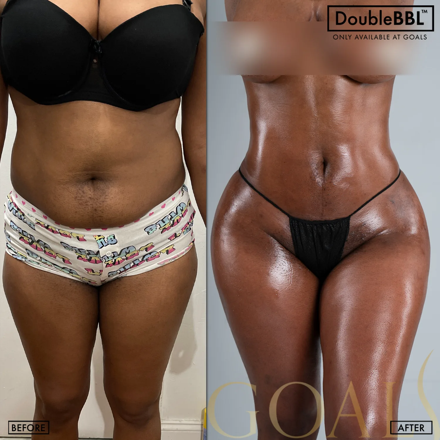 Before and after, patient 5