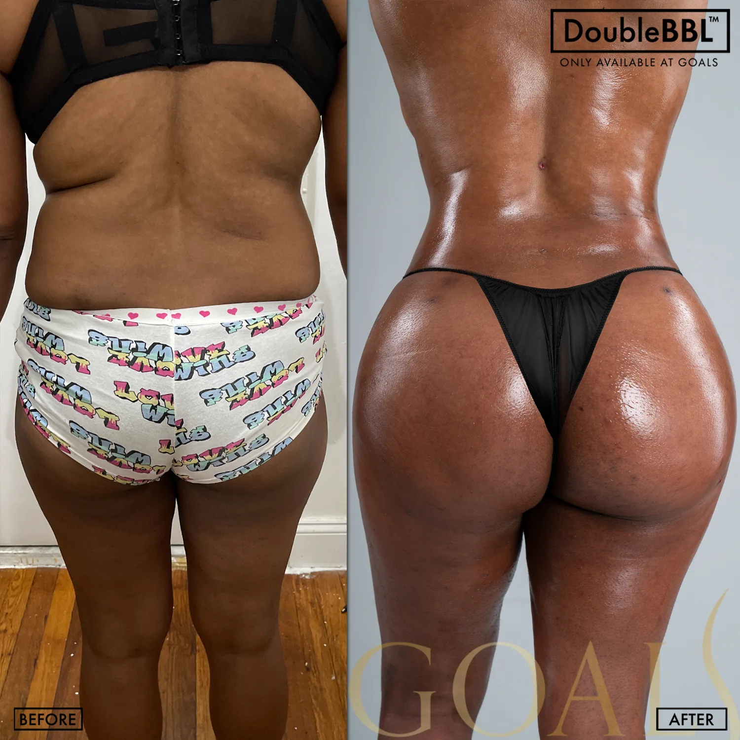 Before and after, patient 6