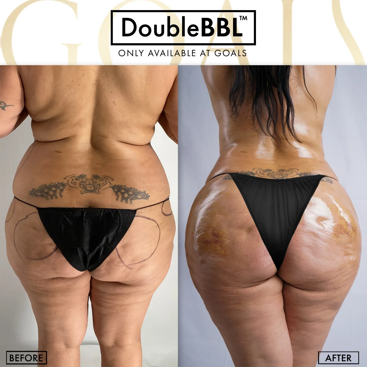 Before and after, patient 2