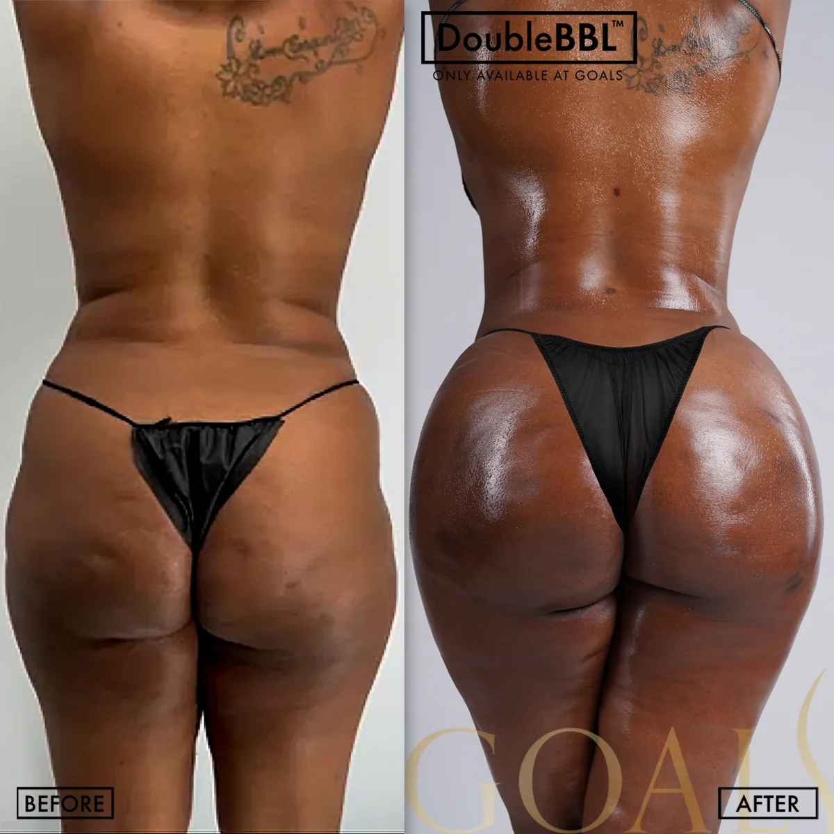 Before and after, patient 2