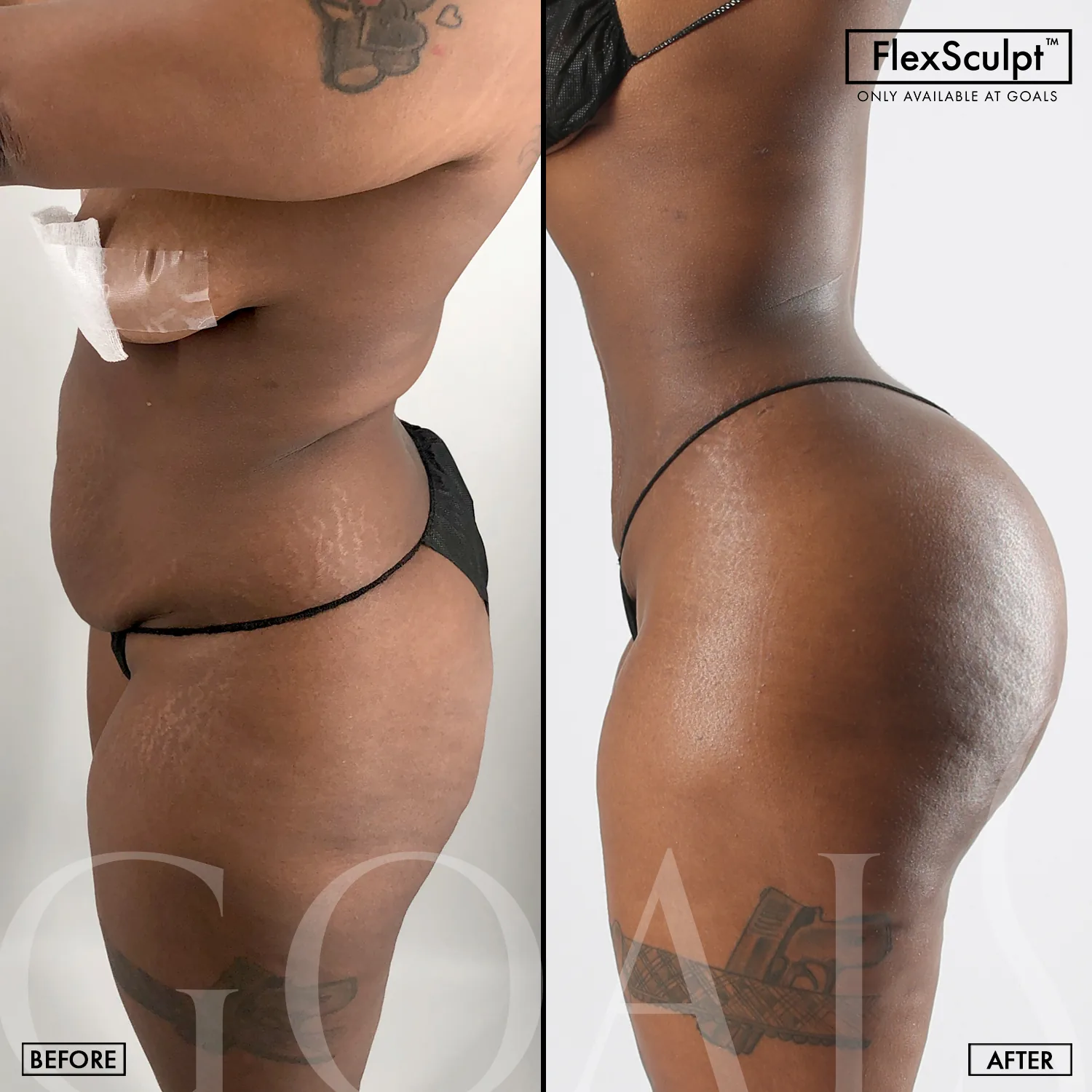 Before and after, patient 6