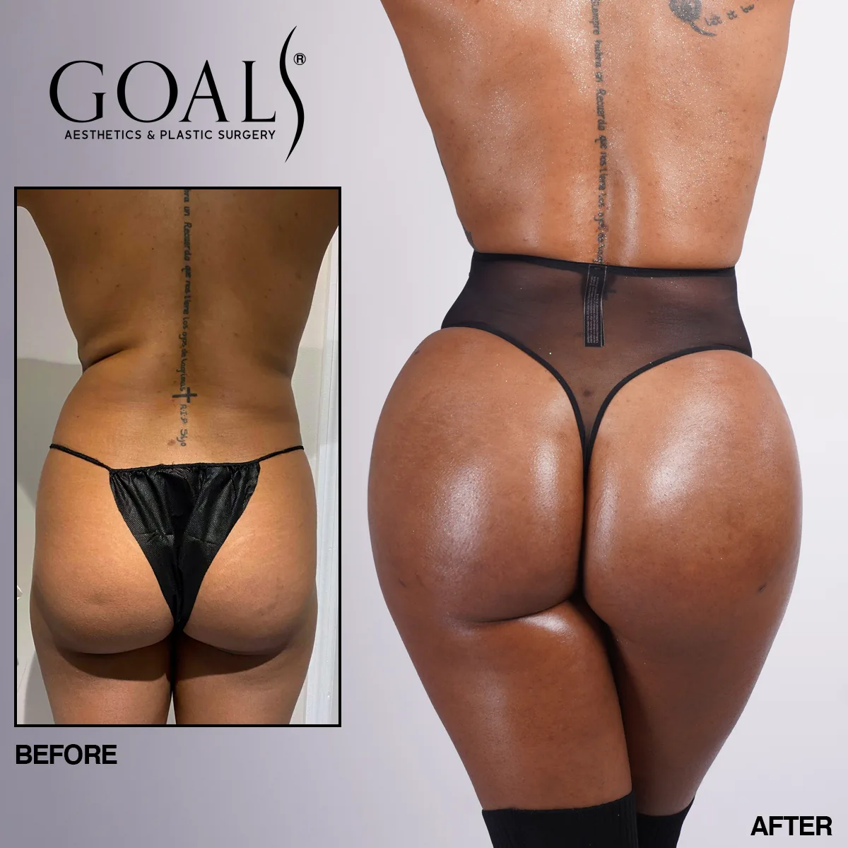 Before and after, patient 2