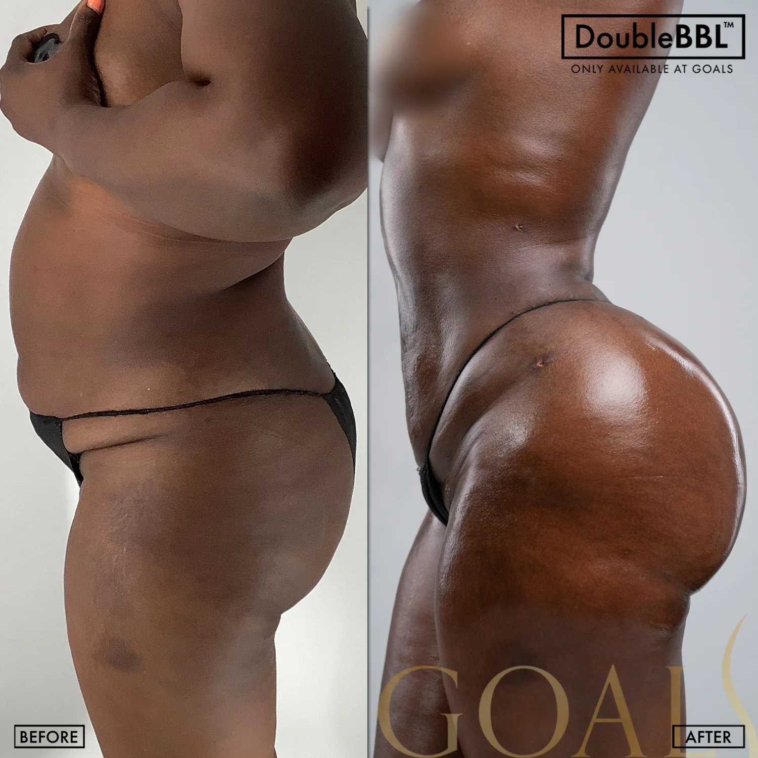 Before and after, patient 2