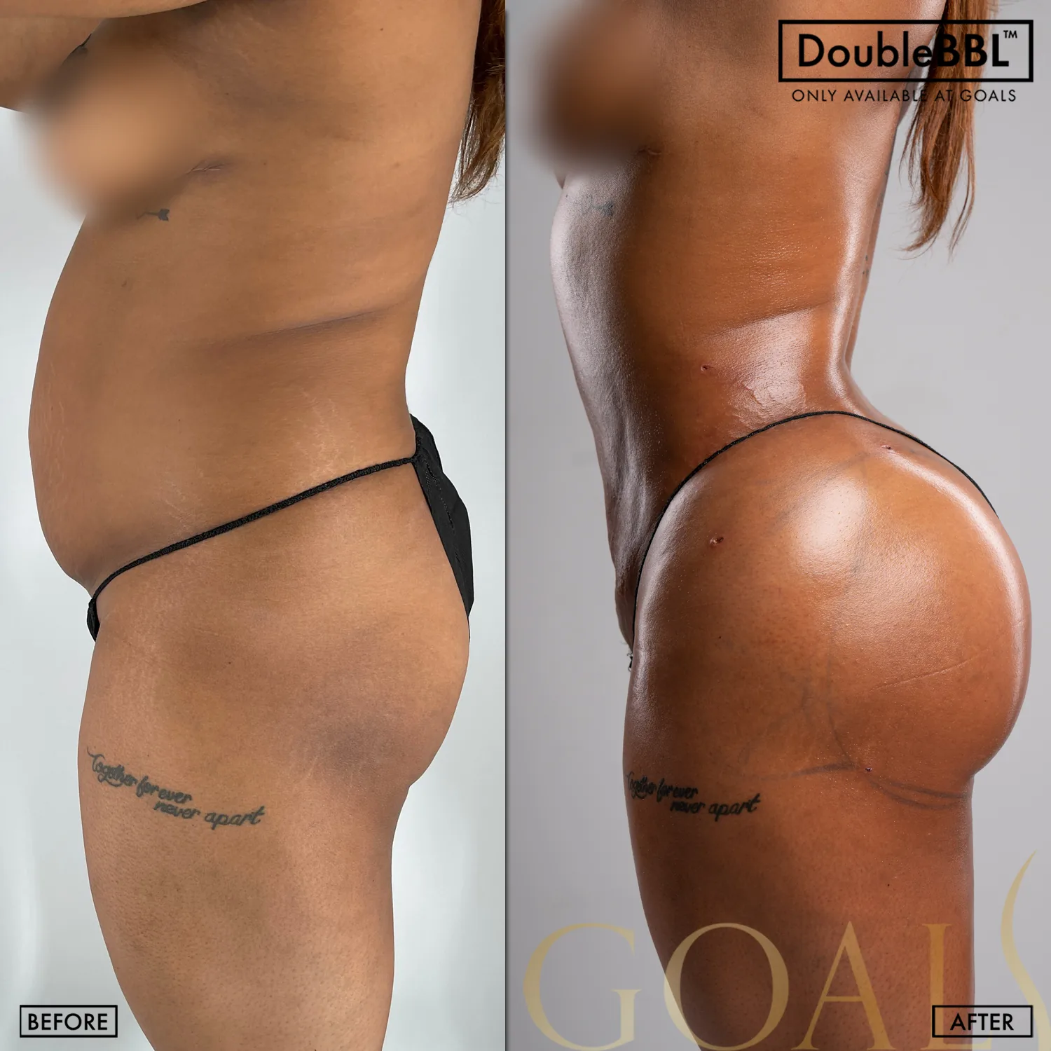 Before and after, patient 5