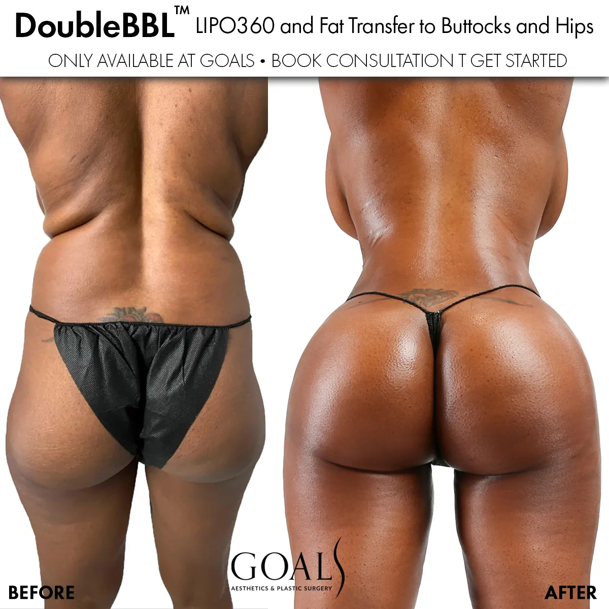 Before and after — Houston, patient 2
