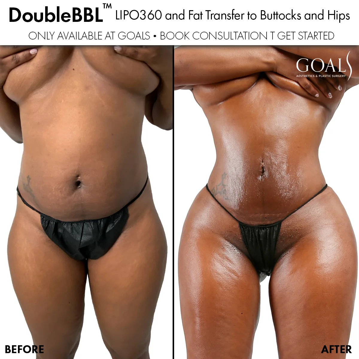 Before and after — Houston, patient 3