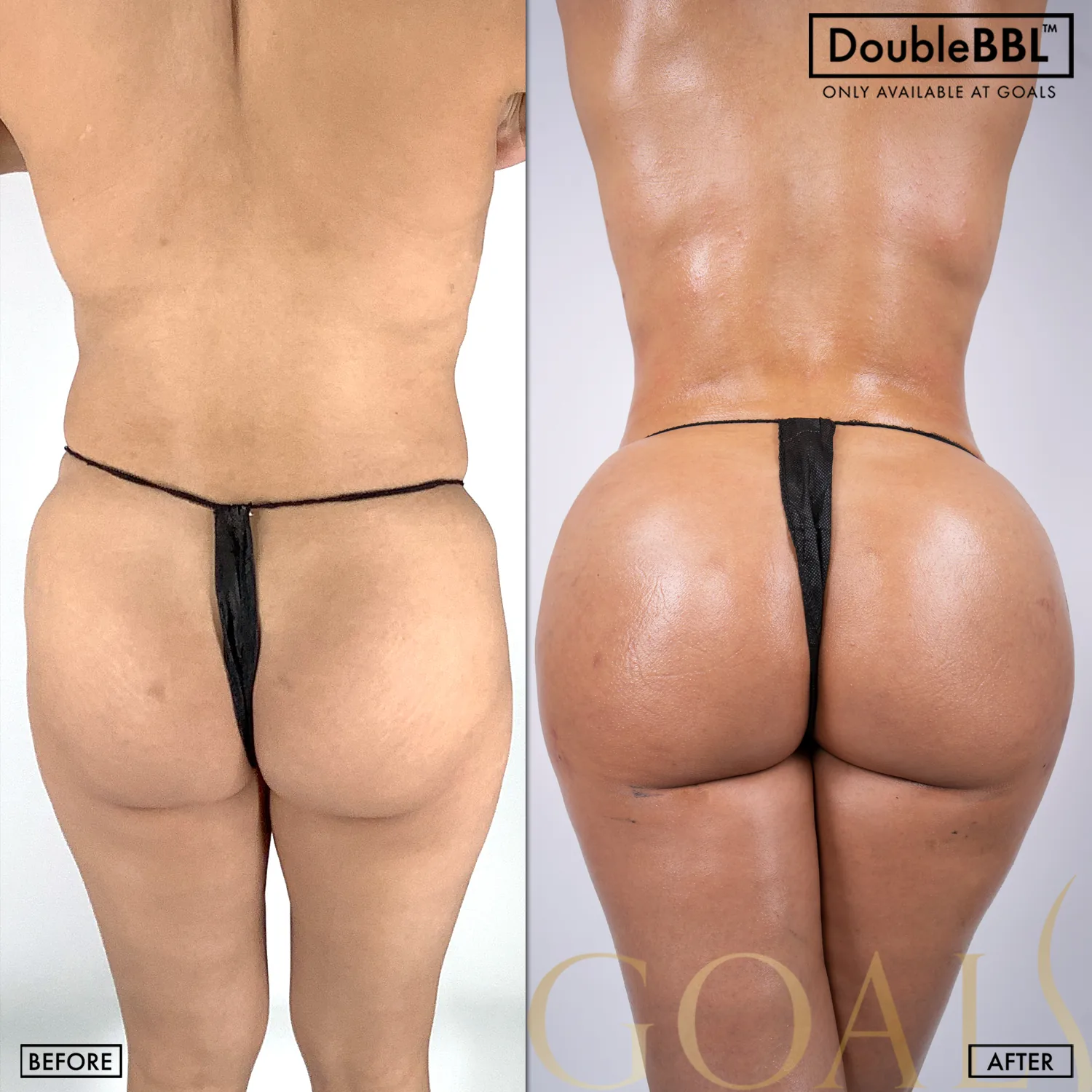 Before and after — Houston, patient 6