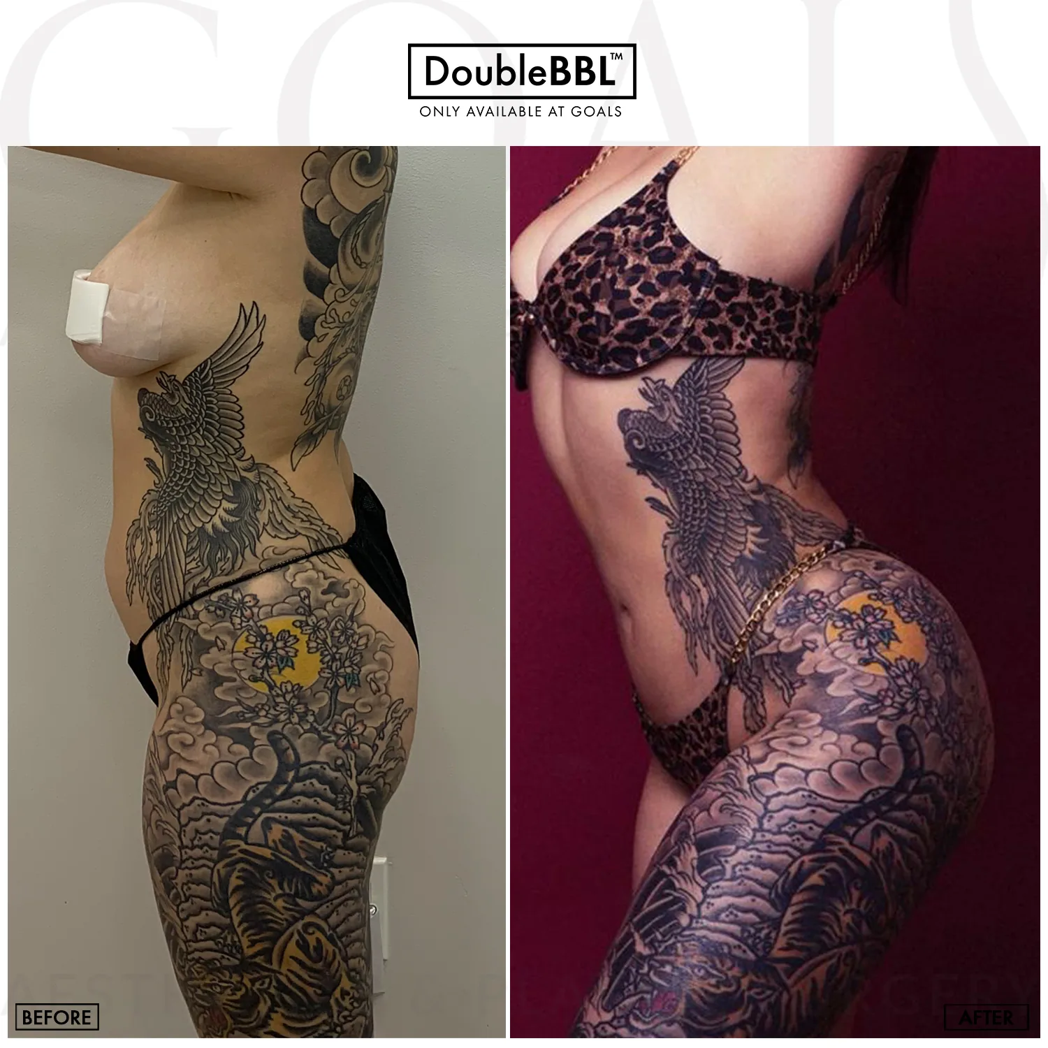 Before and after — Gaithersburg, patient 2
