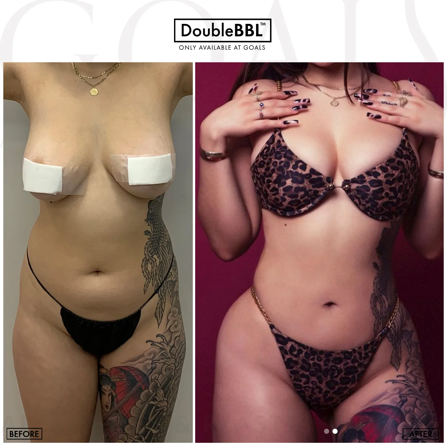 Before and after — Gaithersburg, patient 4