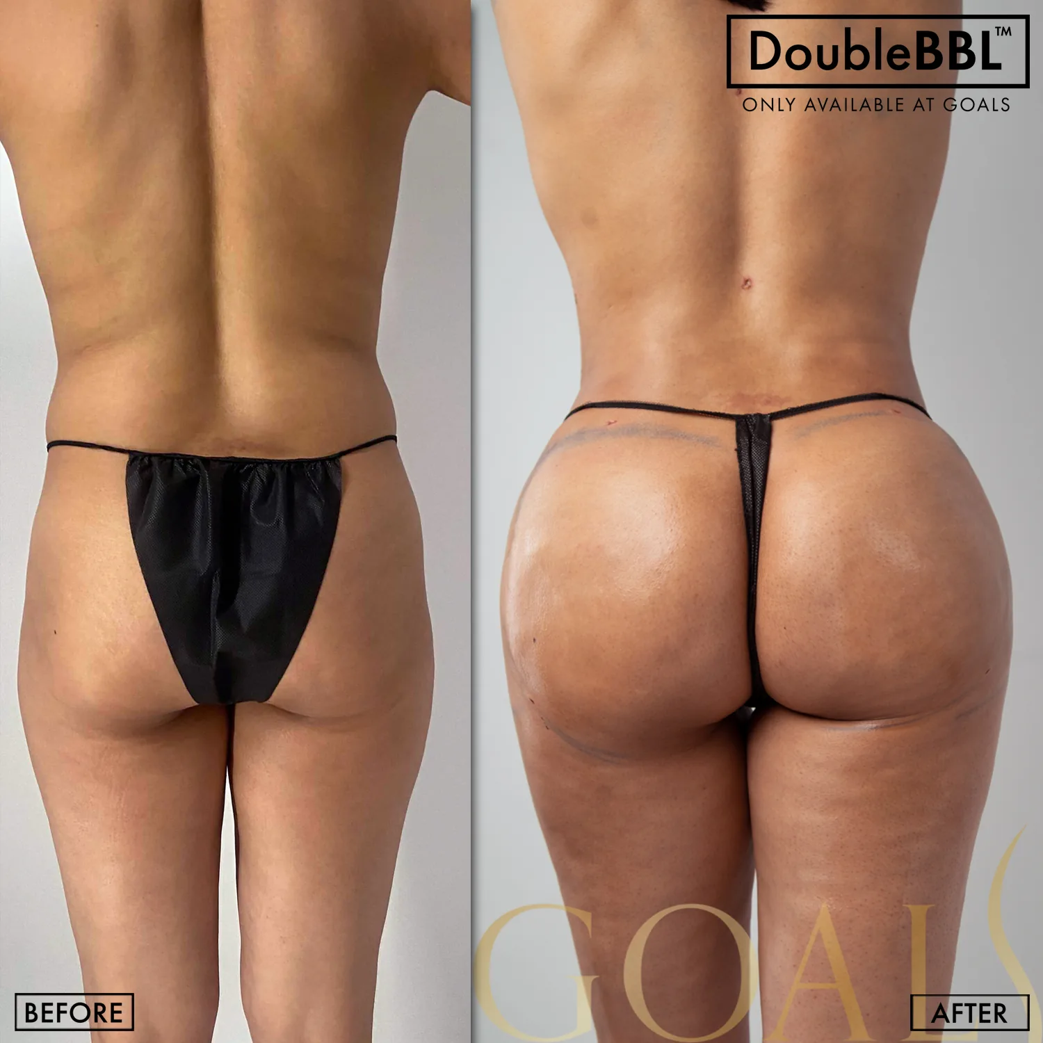 Before and after — Gaithersburg, patient 6