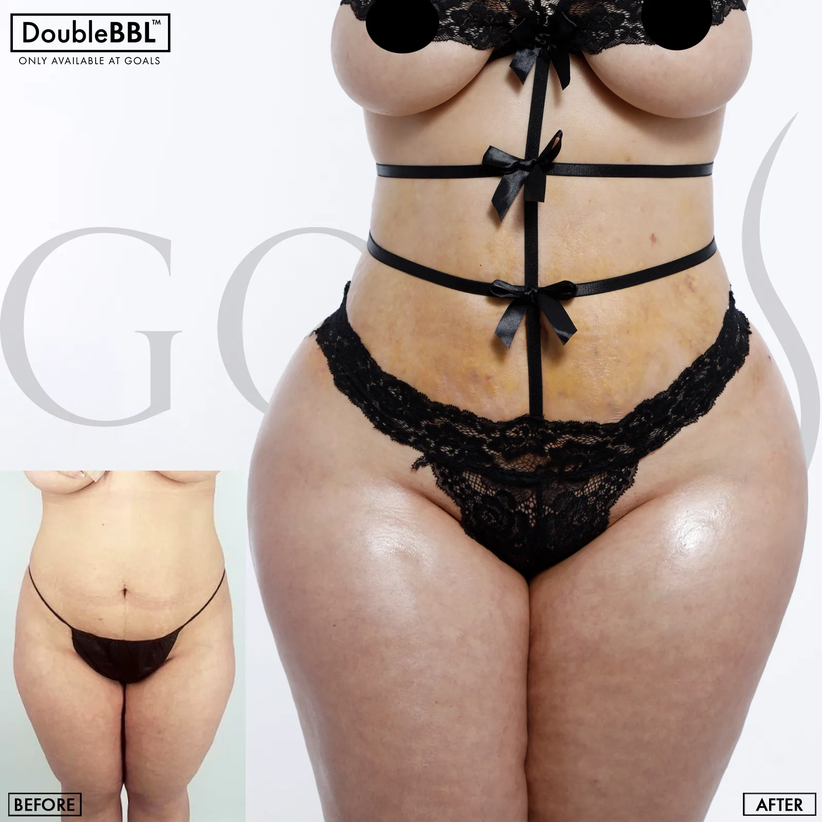 Before and after — Gaithersburg, patient 3