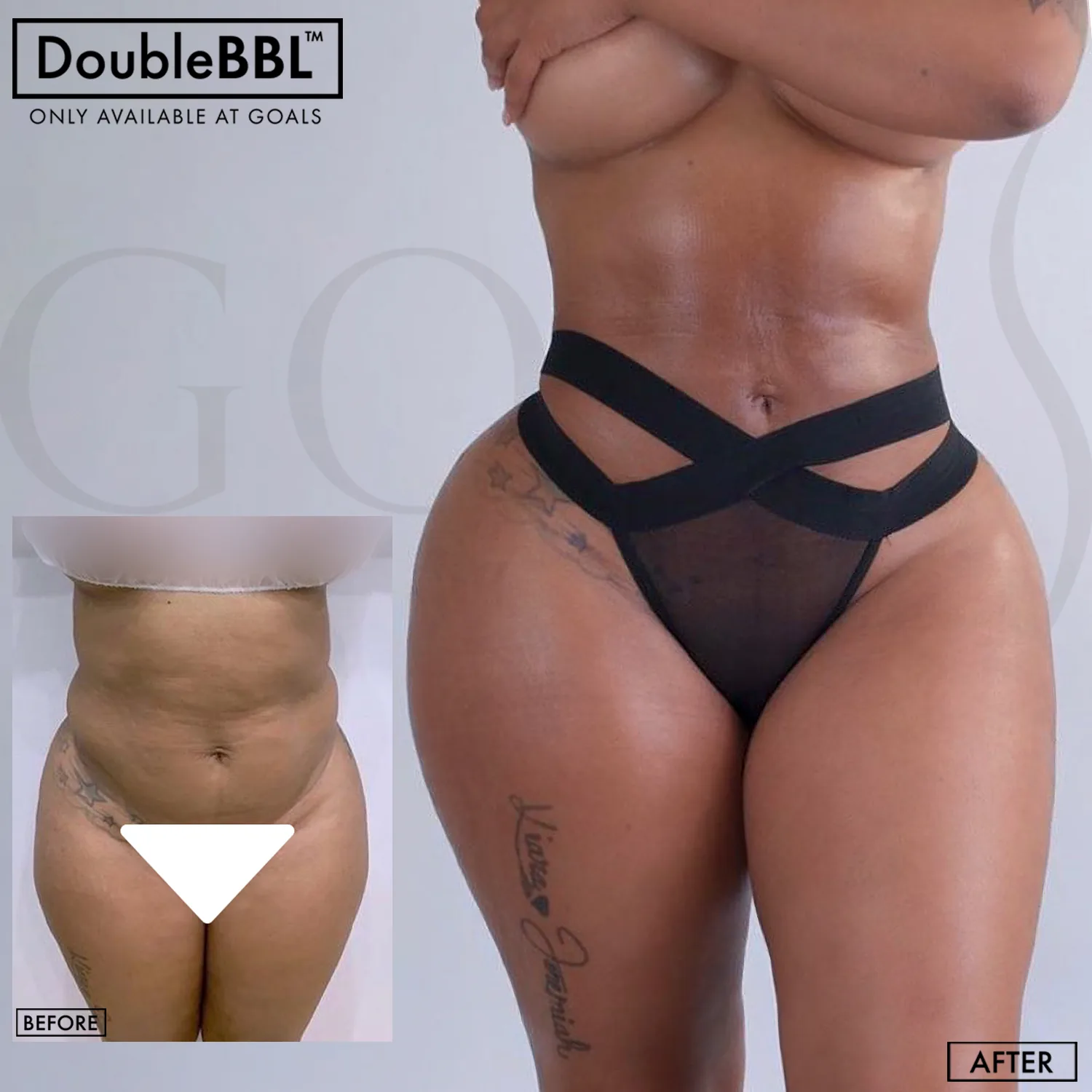 Before and after — Brooklyn, patient 1