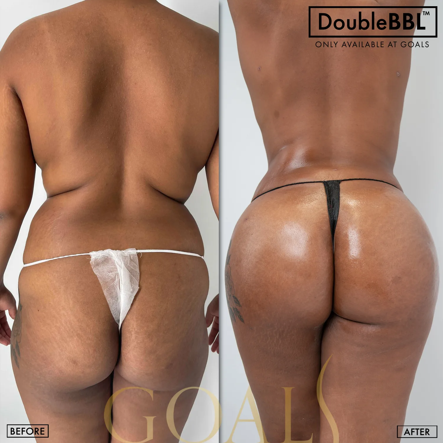 Before and after, patient 2