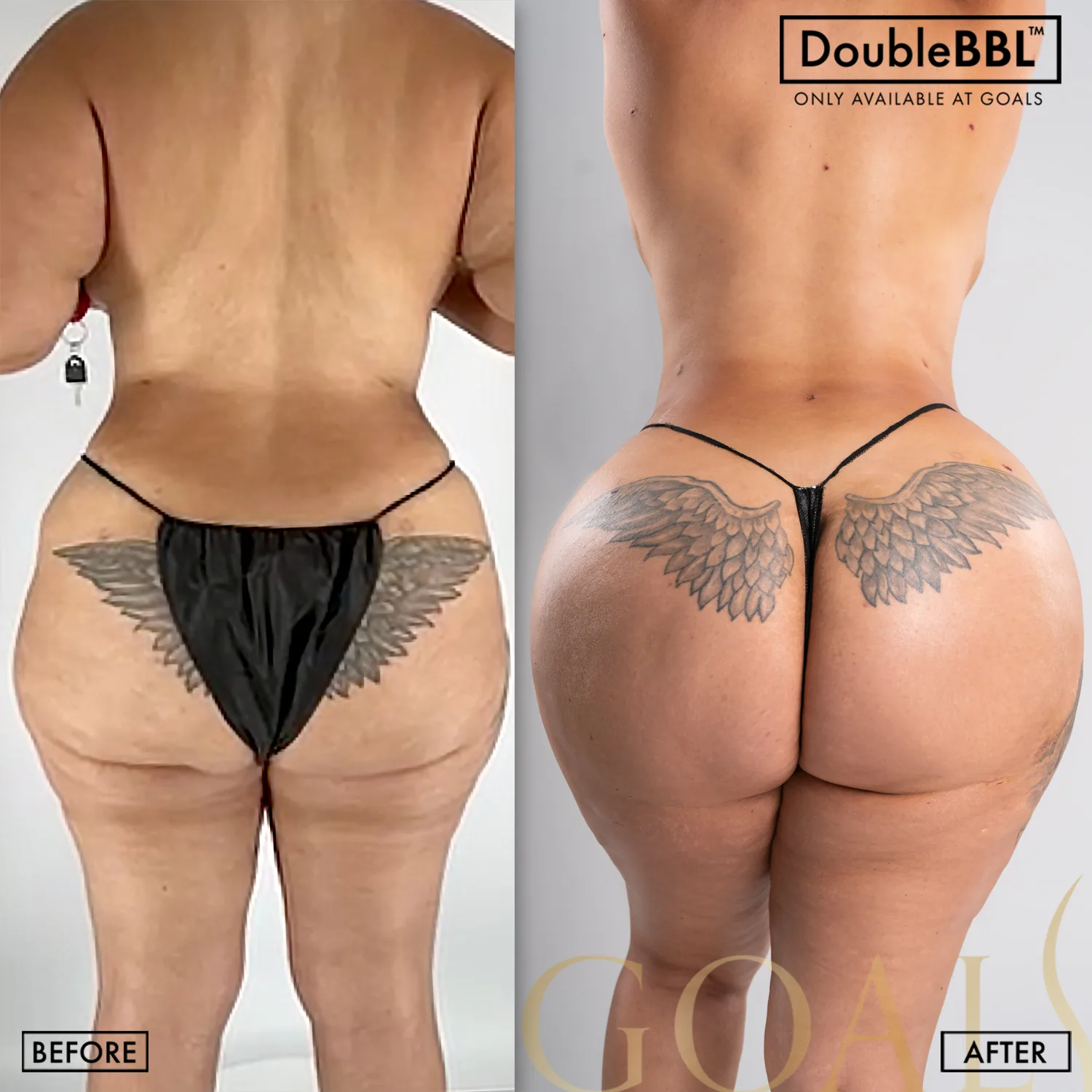 Before and after, patient 4