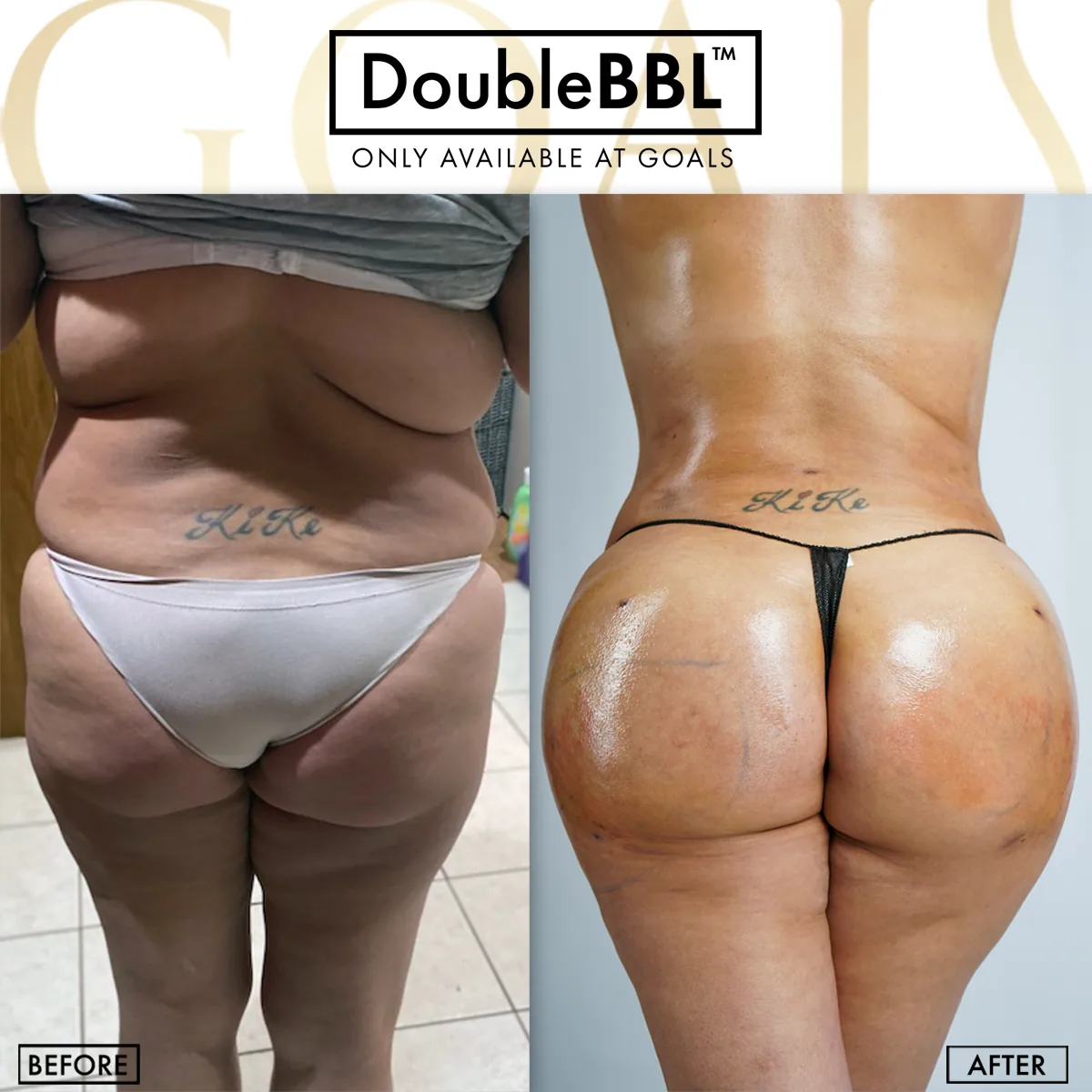Before and after, patient 5
