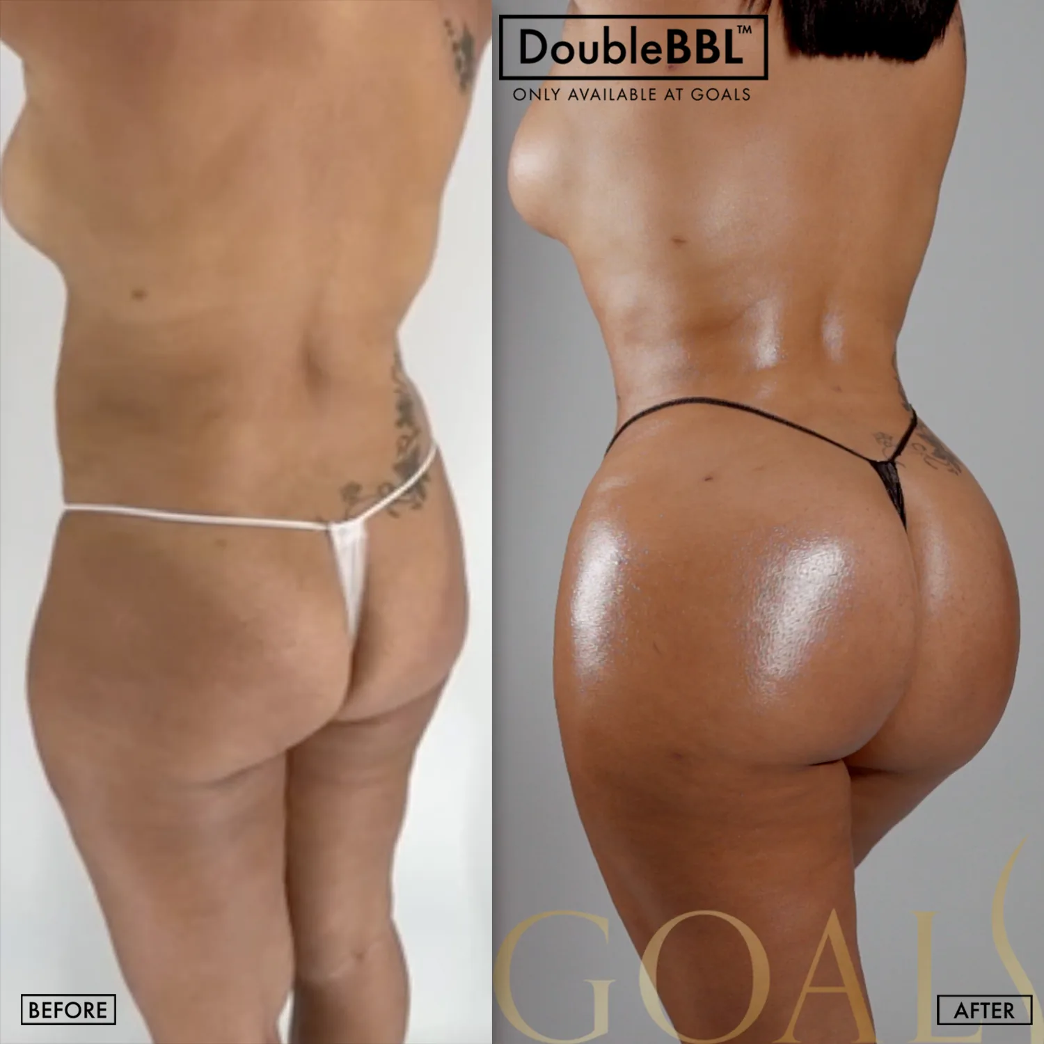 Before and after, patient 6