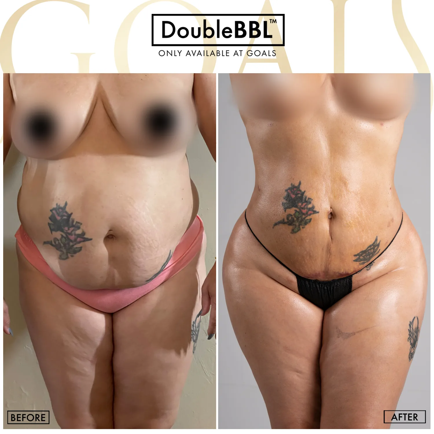 Before and after, patient 6