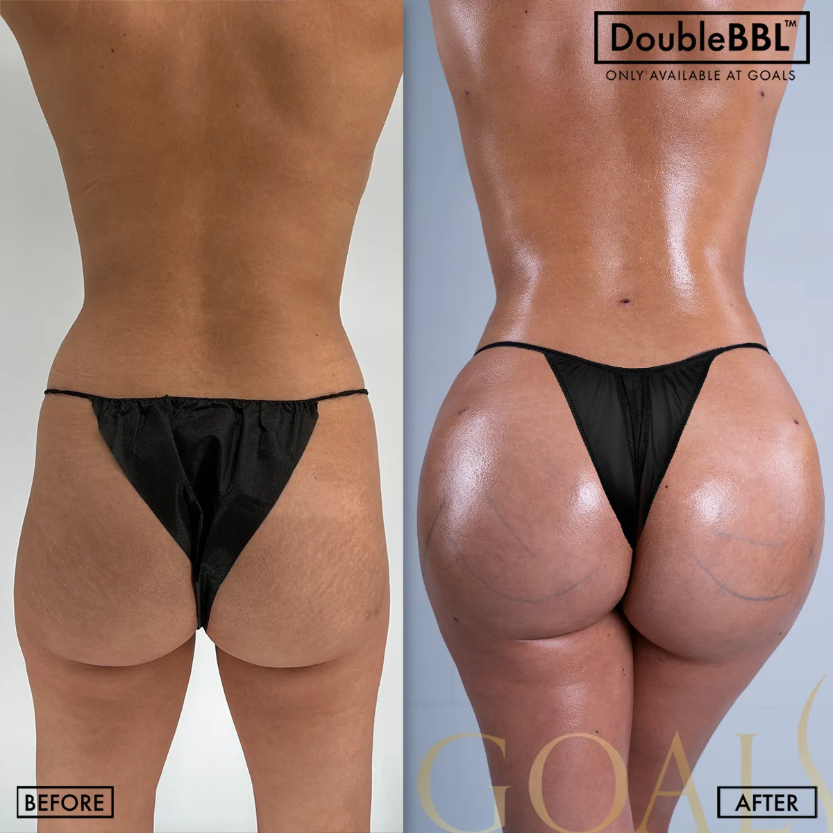 Before and after, patient 2