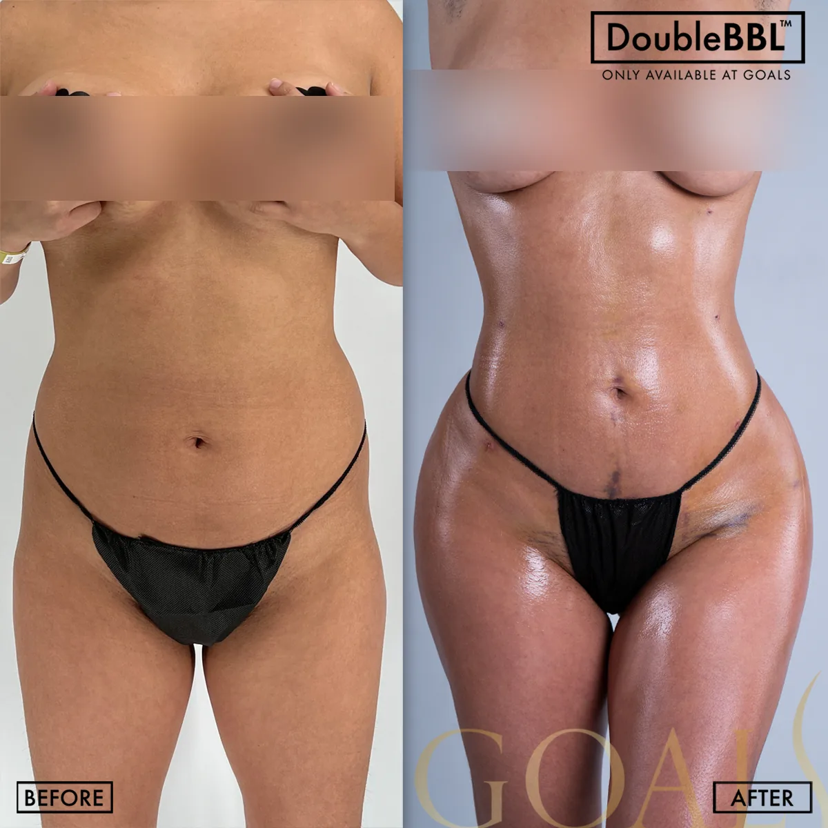 Before and after, patient 4