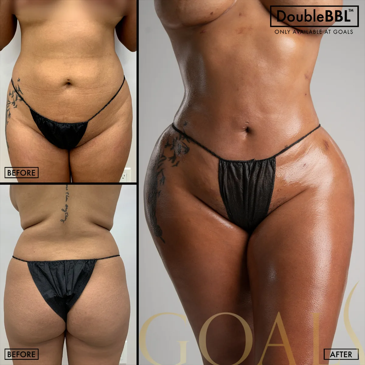Before and after, patient 5