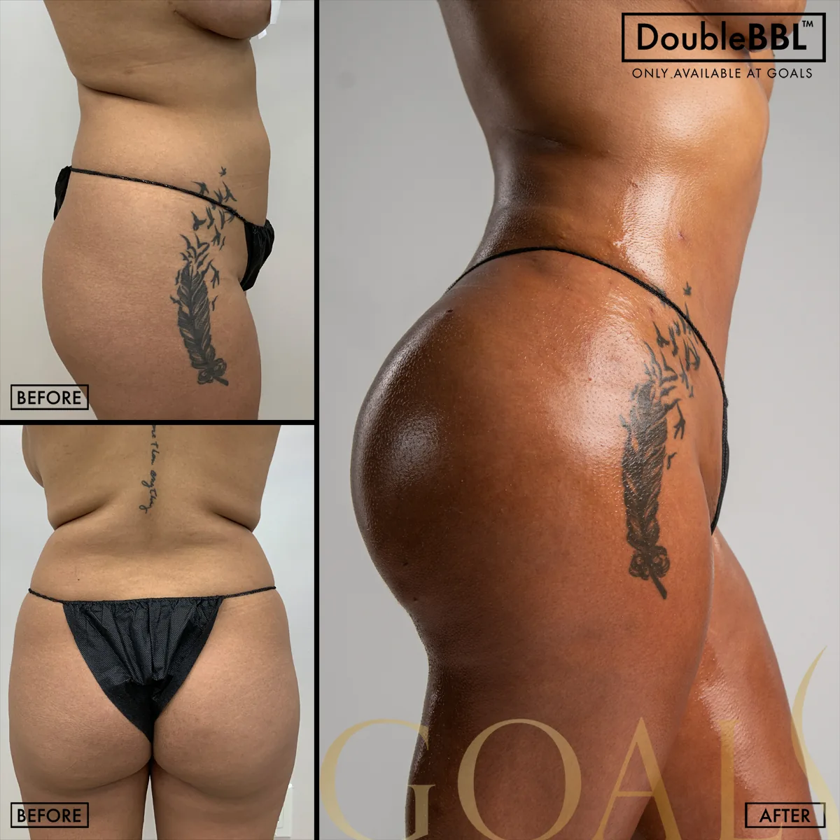 Before and after, patient 6