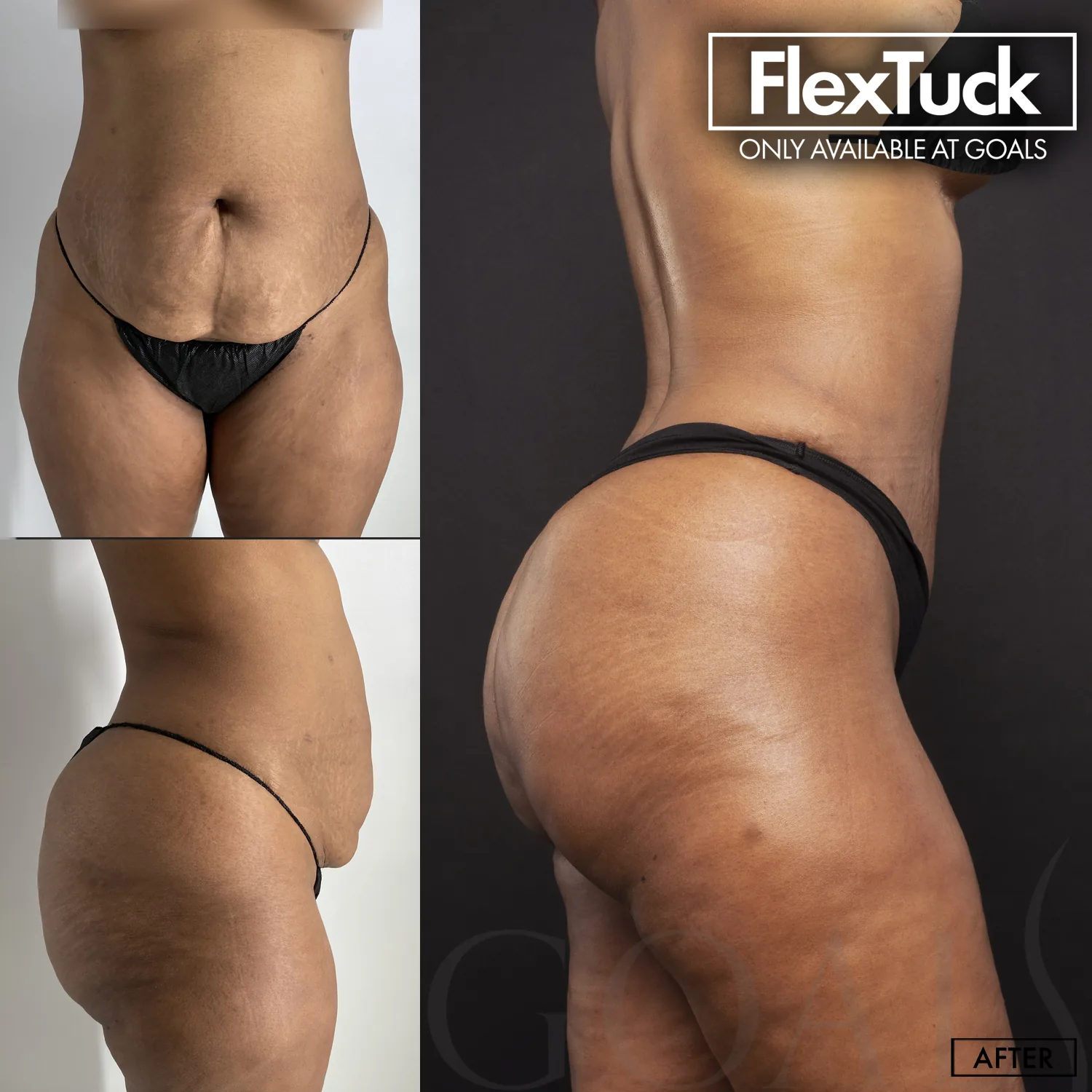 Before and after, patient 3