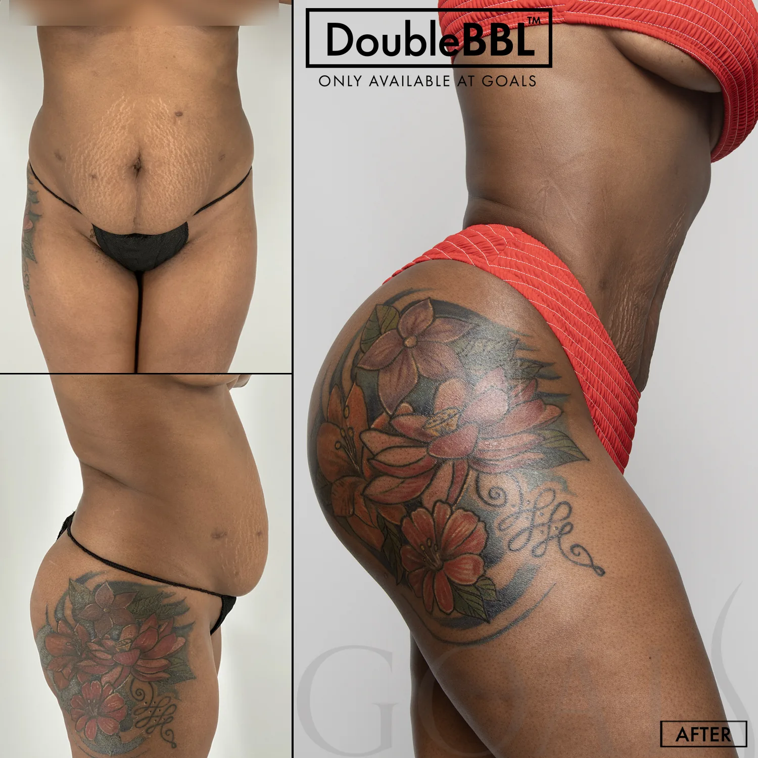 Before and after, patient 6