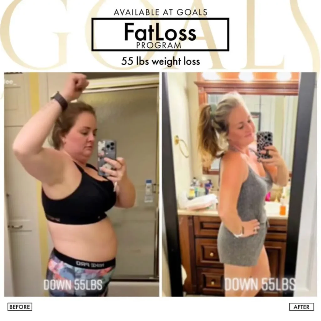 Before and after — Fat Loss Shots, patient 1