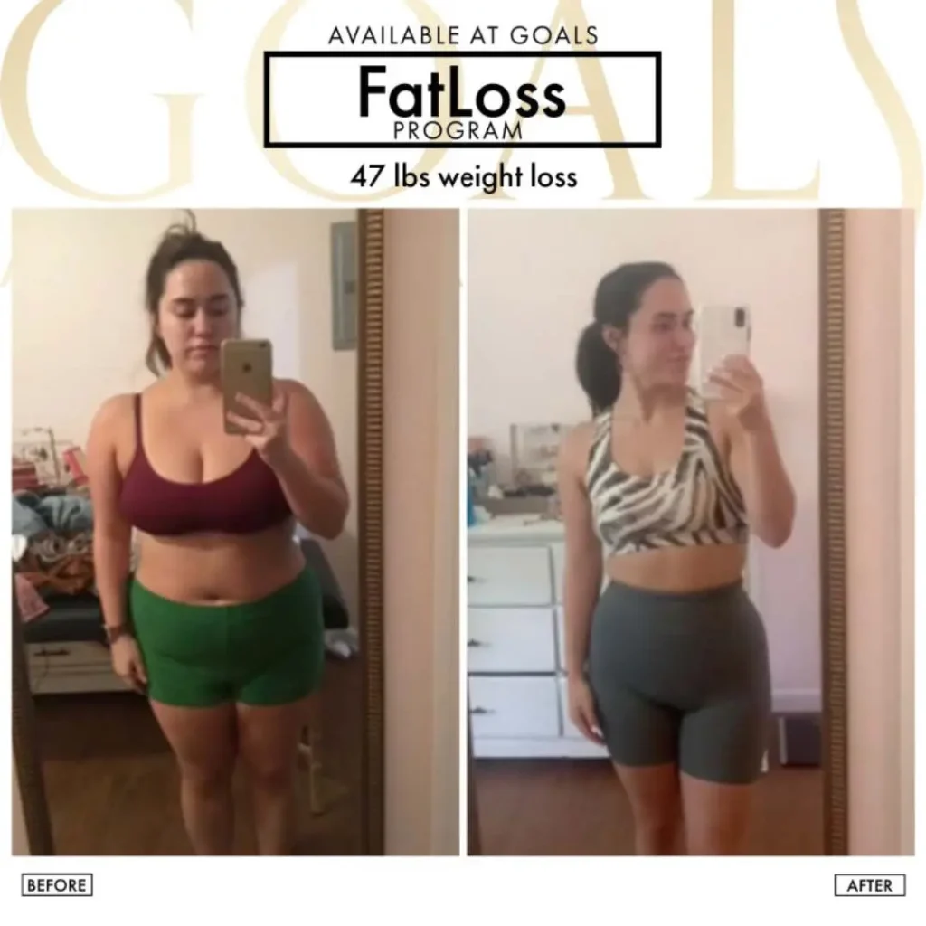 Before and after — Fat Loss Shots, patient 2