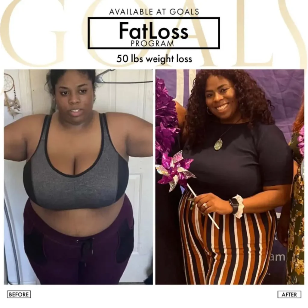 Before and after — Fat Loss Shots, patient 3