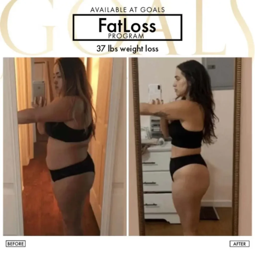Before and after — Fat Loss Shots · Atlanta Walton St., patient 2