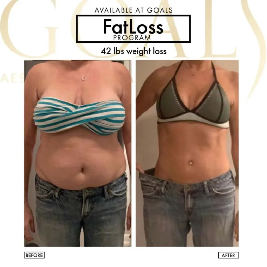 Fat Loss Shots — patient result