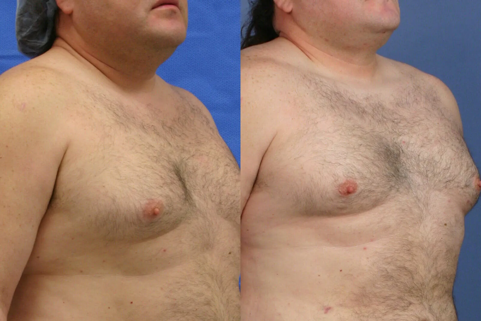 Before and after, patient 6