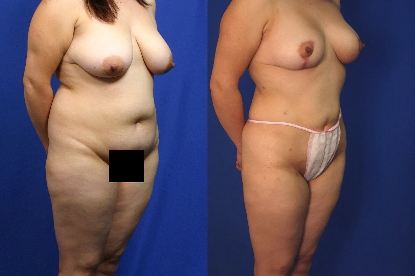 Before and after, patient 5