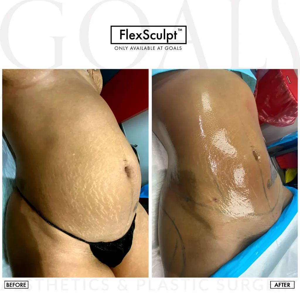 Before and after, patient 6