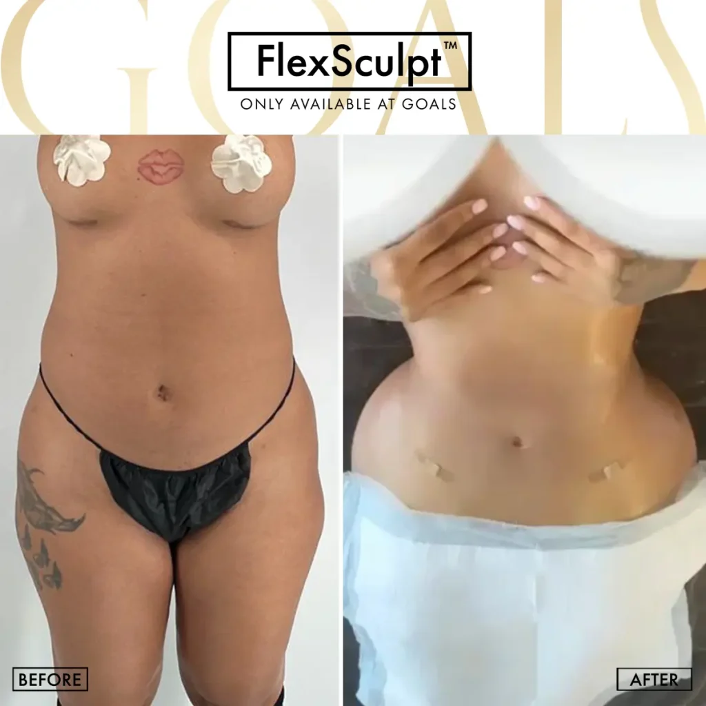 Before and after — Los Angeles, patient 3